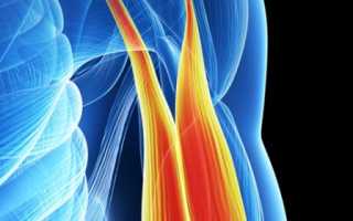 Мышечные патологии: основные причины возникновения миопатии