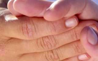 Причины и методы лечения боли в кистях рук и запястье