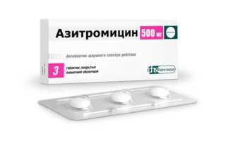 Популярные 15 таблеток от фарингита: быстрая и эффективная помощь
