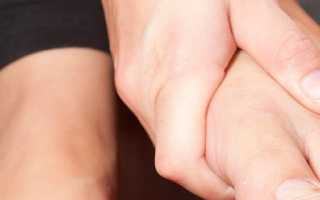Почему сводит пальцы на ногах: причины, симптомы, лечение