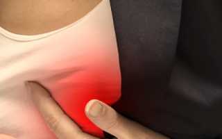 Основные причины возникновения боли под правой грудиной у женщин?