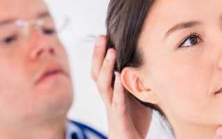 Симптомы и лечение спондилоартроза шейного отдела позвоночника