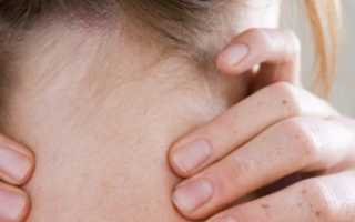 Эффективные методы лечения застуженной шеи