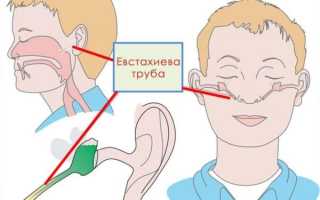 Что делать, если заложило ухо при насморке: методы лечения в домашних условиях