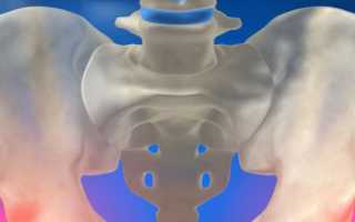 Эндопротезирование тазобедренного сустава — проведение операции и реабилитация