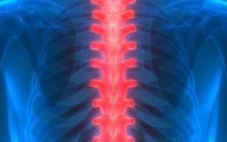 Симптомы и лечение сирингомиелии шейного и грудного отделов позвоночника