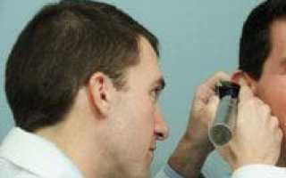 Грибок ушей у людей: симптомы и лечение, как выглядит ушное грибковое заболевание