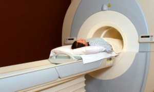 Как и для чего проводится МРТ коленного сустава