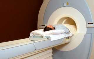 Как и для чего проводится МРТ коленного сустава