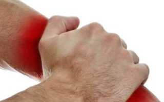Причины возникновения и лечение ушиба руки в домашних условиях