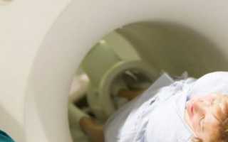 МРТ грудной клетки: показания и преимущества обследования