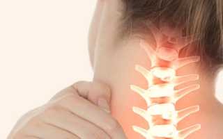 Медикаментозное лечение шейного остеохондроза и его симптомы