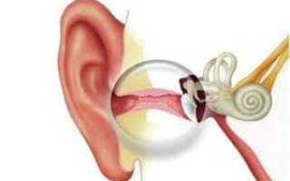 Как выглядит отит в ухе и все про воспаление среднего уха у человека: симптомы и лечение