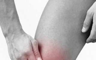 Симптомы, стадии и лечение тендинита коленного сустава и собственной связки надколенника
