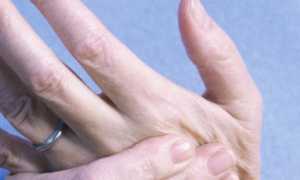 Что делать, если болят кончики пальцев на руках?