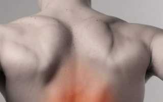 Спондилоартроз грудного отдела позвоночника: основные признаки и лечение