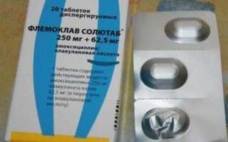 Тонзиллит: антибиотики для лечения взрослым – список лучших