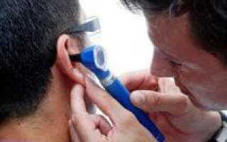 Анауран: инструкция по применению ушных капель при отите и перфорации ушной перепонки
