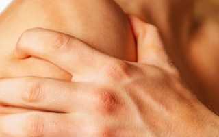 Артроз плечевого сустава: основные симптомы и методы лечения в домашних условиях