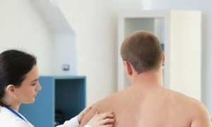 Симптомы и лечение при разрыве связок и сухожилий плечевого сустава