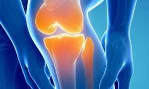 Физиопроцедуры и гимнастика при артрозе коленного сустава