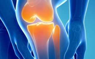 Физиопроцедуры и гимнастика при артрозе коленного сустава
