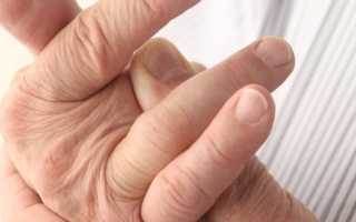 Артрит пальцев рук — причины, симптомы и методы лечения в домашних условиях
