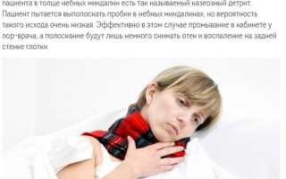 Как полоскать горло Хлоргексидином ребенку – инструкция по применению для полоскания детям