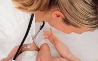 Причины, симптомы и принципы лечения рахита у детей