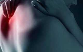 Симптомы и лечение защемления нерва в плечевом суставе