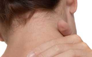 Причины, симптомы и методы лечения миозита шеи
