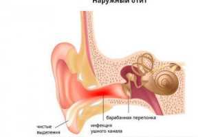 Заболевания уха у людей: какие бывают, их симптомы и методы лечения